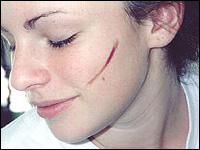 Creating Scars & Burns with Collodion Creating Scars & Burns with Collodion