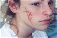 Creating Scars & Burns with Collodion Creating Scars & Burns with Collodion